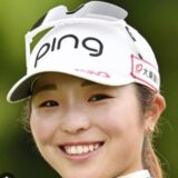 佐久間朱莉の口元が気になる理由は？口蓋裂の噂と真相を解説